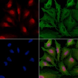 Invitrogen ZNF24 Polyclonal Antibody 100 &mu;L; Unconjugated:Antibodies,