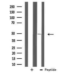 Invitrogen ZNF24 Polyclonal Antibody 100 &mu;L; Unconjugated:Antibodies,