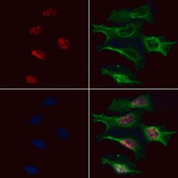 Invitrogen ATF7 Polyclonal Antibody 100 &mu;L | Buy Online | Invitrogen&trade; | Fisher Scientific