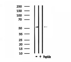 Invitrogen ATF7 Polyclonal Antibody 100 &mu;L | Buy Online | Invitrogen&trade; | Fisher Scientific