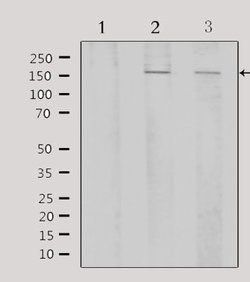 Invitrogen ATF7 Polyclonal Antibody 100 &mu;L | Buy Online | Invitrogen&trade; | Fisher Scientific