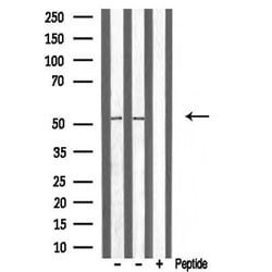 Invitrogen ATF7 Polyclonal Antibody 100 &mu;L | Buy Online | Invitrogen&trade; | Fisher Scientific