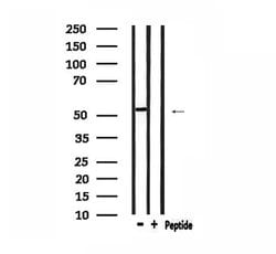 Invitrogen PKA beta Polyclonal Antibody 100 &mu;L; Unconjugated:Antibodies,