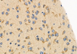 Invitrogen PKA beta Polyclonal Antibody 100 &mu;L; Unconjugated:Antibodies,