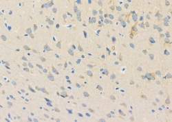 Invitrogen PKA beta Polyclonal Antibody 100 &mu;L; Unconjugated:Antibodies,