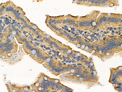 Invitrogen MARK3 Polyclonal Antibody 100 &mu;L; Unconjugated:Antibodies,