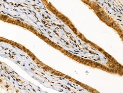 Invitrogen MZF1 Polyclonal Antibody 100 &mu;L; Unconjugated:Antibodies,