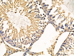Invitrogen Cyclophilin F Polyclonal Antibody 100 &mu;L; Unconjugated:Antibodies,