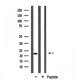 Invitrogen Cyclophilin F Polyclonal Antibody 100 &mu;L; Unconjugated:Antibodies,