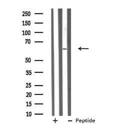 GRK4 Polyclonal Antibody:Antibodies, Polyclonal