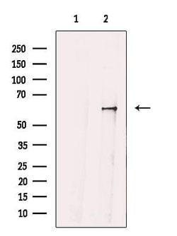 GRK4 Polyclonal Antibody:Antibodies, Polyclonal