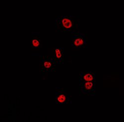 Invitrogen™ CSTF2 Polyclonal Antibody