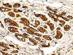 GRK5 Polyclonal Antibody, Invitrogen 100 &mu;L; Unconjugated:Antibodies,