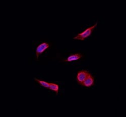 Invitrogen Recoverin Polyclonal Antibody 100 &mu;L; Unconjugated:Antibodies,