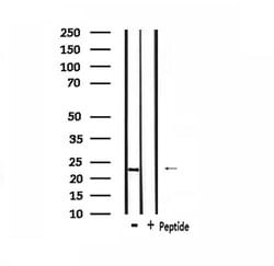Invitrogen Recoverin Polyclonal Antibody 100 &mu;L; Unconjugated:Antibodies,