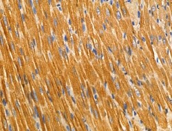 Invitrogen alpha Actinin 2/3 Polyclonal Antibody 100 &mu;L | Buy Online | Invitrogen&trade; | Fisher Scientific