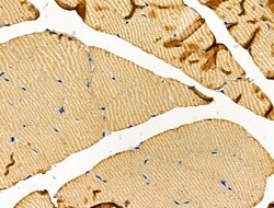 Invitrogen alpha Actinin 2/3 Polyclonal Antibody 100 &mu;L | Buy Online | Invitrogen&trade; | Fisher Scientific