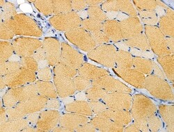 Invitrogen alpha Actinin 2/3 Polyclonal Antibody 100 &mu;L | Buy Online | Invitrogen&trade; | Fisher Scientific