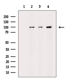 Invitrogen alpha Actinin 2/3 Polyclonal Antibody 100 &mu;L | Buy Online | Invitrogen&trade; | Fisher Scientific