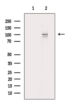 Invitrogen alpha Actinin 2/3 Polyclonal Antibody 100 &mu;L | Buy Online | Invitrogen&trade; | Fisher Scientific