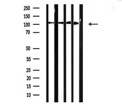 Invitrogen alpha Actinin 2/3 Polyclonal Antibody 100 &mu;L | Buy Online | Invitrogen&trade; | Fisher Scientific