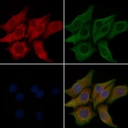 Invitrogen PHKA1/PHKA2 Polyclonal Antibody 100 &mu;L; Unconjugated:Antibodies,
