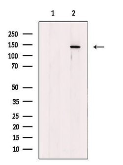 Invitrogen PHKA1/PHKA2 Polyclonal Antibody 100 &mu;L; Unconjugated:Antibodies,