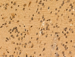 Invitrogen MEOX2 Polyclonal Antibody 100 &mu;L | Buy Online | Invitrogen&trade; | Fisher Scientific