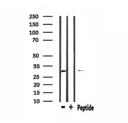Invitrogen MEOX2 Polyclonal Antibody 100 &mu;L | Buy Online | Invitrogen&trade; | Fisher Scientific