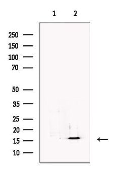 Invitrogen RBP5 Polyclonal Antibody 100 &mu;L; Unconjugated:Antibodies,