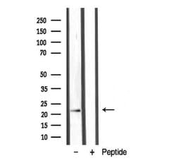 Invitrogen LTB Polyclonal Antibody 100 &mu;L | Buy Online | Invitrogen&trade; | Fisher Scientific