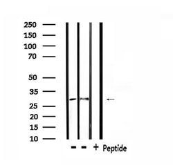 CD137 Polyclonal Antibody:Antibodies, Polyclonal