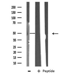 Invitrogen ITPK1 Polyclonal Antibody 100 &mu;L | Buy Online | Invitrogen&trade; | Fisher Scientific