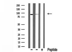 Invitrogen DYRK1A Polyclonal Antibody 100 &mu;L; Unconjugated:Antibodies,