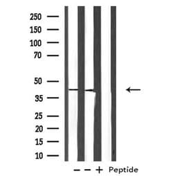 Invitrogen PDGFRL Polyclonal Antibody 100 μL; Unconjugated:Antibodies,
