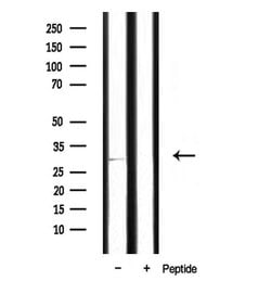 Invitrogen SURF1 Polyclonal Antibody 100 &mu;L; Unconjugated:Antibodies,