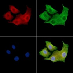 Invitrogen ADCK5 Polyclonal Antibody 100 μL; Unconjugated:Antibodies,
