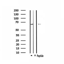 Invitrogen ADCK5 Polyclonal Antibody 100 μL; Unconjugated:Antibodies,