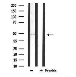 Invitrogen AGPAT9 Polyclonal Antibody 100 μL; Unconjugated:Antibodies,