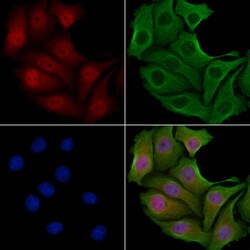 TSSC1 Polyclonal Antibody, Invitrogen&trade;