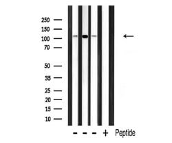 Invitrogen RBM26 Polyclonal Antibody 100 &mu;L; Unconjugated:Antibodies,