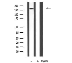 Invitrogen MAST2 Polyclonal Antibody 100 μL; Unconjugated:Antibodies,