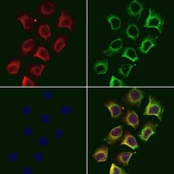 Invitrogen MARK2 Polyclonal Antibody 100 &mu;L; Unconjugated:Antibodies,