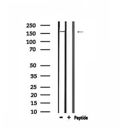 Invitrogen LMTK2 Polyclonal Antibody 100 &mu;L; Unconjugated:Antibodies,