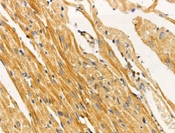Invitrogen TUSC5 Polyclonal Antibody 100 &mu;L; Unconjugated:Antibodies,