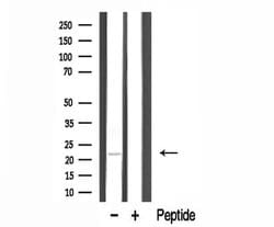Invitrogen TUSC5 Polyclonal Antibody 100 &mu;L; Unconjugated:Antibodies,