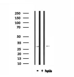 Invitrogen SPIC Polyclonal Antibody 100 &mu;L | Buy Online | Invitrogen&trade; | Fisher Scientific