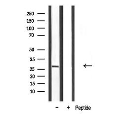 Invitrogen SPIC Polyclonal Antibody 100 &mu;L | Buy Online | Invitrogen&trade; | Fisher Scientific