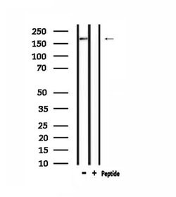 Invitrogen ARID1B Polyclonal Antibody 100 &mu;L | Buy Online | Invitrogen&trade; | Fisher Scientific