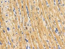 Invitrogen CABC1 Polyclonal Antibody 100 &mu;L; Unconjugated:Antibodies,